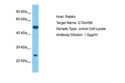 C16orf58 Rabbit anti-Human, Polyclonal, Novus Biologicals 0.1 mL | Buy Online | Novus Biologicals | Fisher Scientific